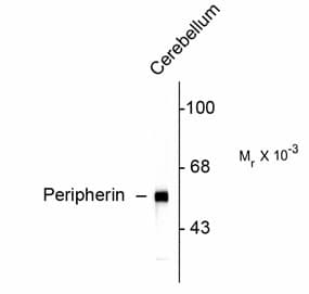 Monoclonal Mouse anti-Rat Peripherin Antibody (IF, WB)
