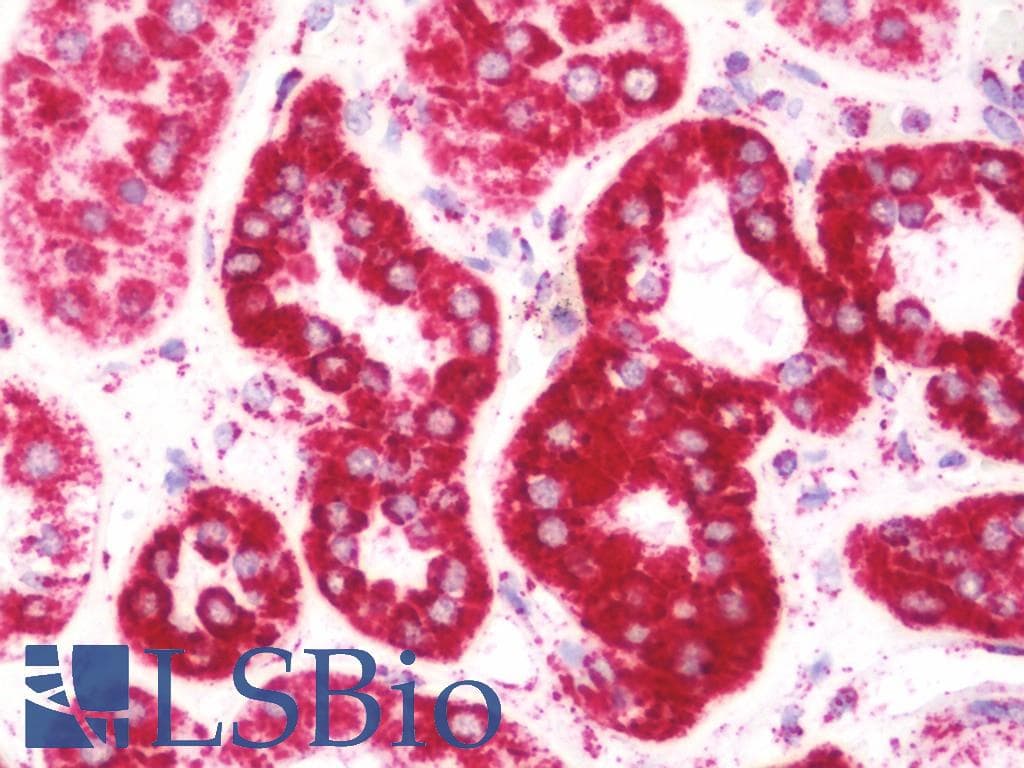 IHC-plus™ Polyclonal Rabbit anti-Human COXIV / COX4 Antibody (aa1-169, IHC, WB)