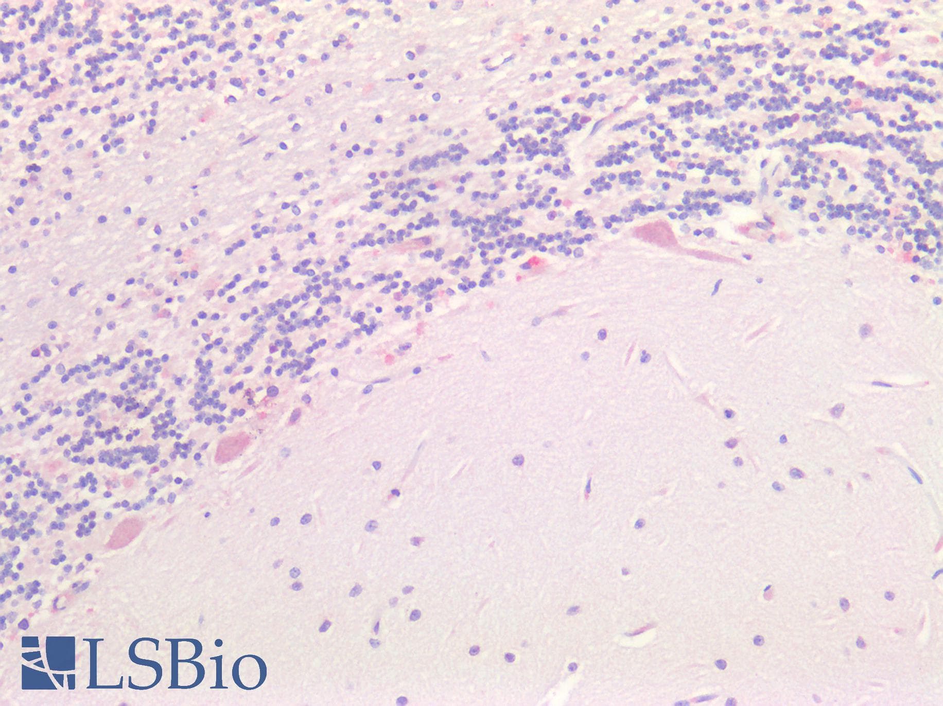 PathPlus™ SORT1 / Sortilin Antibody