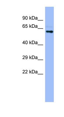 CYPIVA22 / CYP4A22 Antibody (aa35-84)