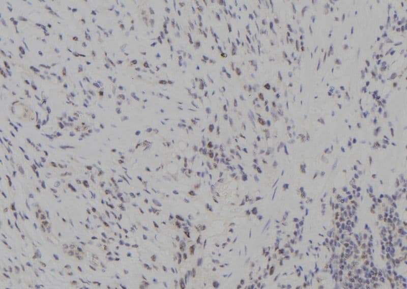 NAK / TBK1 Antibody