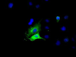 IHC-plus™ GPI Antibody (clone 4B11)