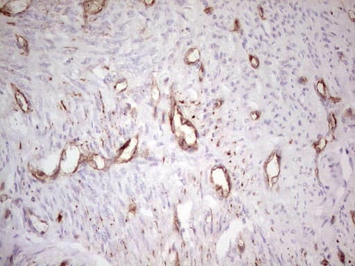 ABCB1 / MDR1 / P Glycoprotein Antibody (aa995-1280, clone OTI1A7)