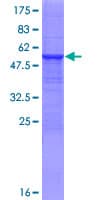 Human CYP3A43 Protein (Recombinant GST)