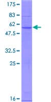 Human C25H / CH25H Protein (Recombinant GST)