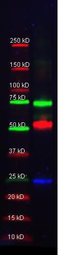 SERPINA1 / Alpha 1 Antitrypsin Antibody