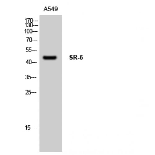 HTR6 / 5-HT6 Receptor Antibody (190-270 aa, Internal)