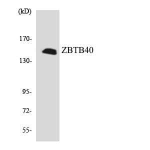 Polyclonal Rabbit anti-Human ZBTB40 Antibody (aa1113-1162, IHC, WB)