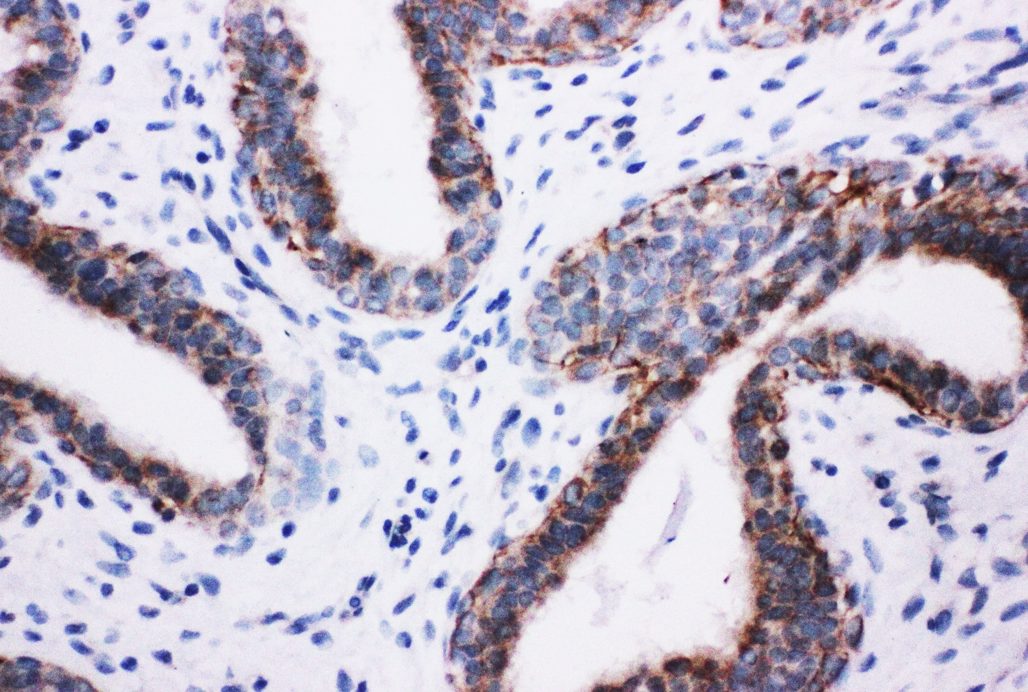 PIK3R2 / p85 Beta Antibody (aa447-461)