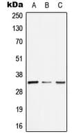 GTF2E2 Antibody (Internal)