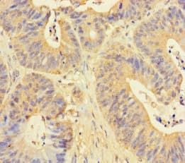 DDOST / OST48 Antibody