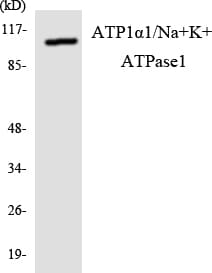 ATP1A1 Antibody (aa11-60)