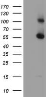 RBM46 Antibody (clone OTI1D6)