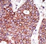 GCNT1 / C2GNT Antibody (aa399-428)