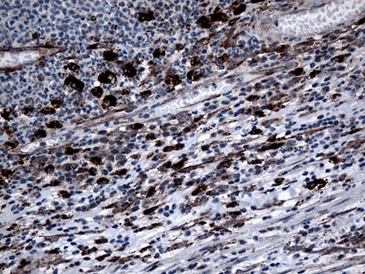 CTSL / Cathepsin L Antibody (aa114-333, clone OTI2C10)