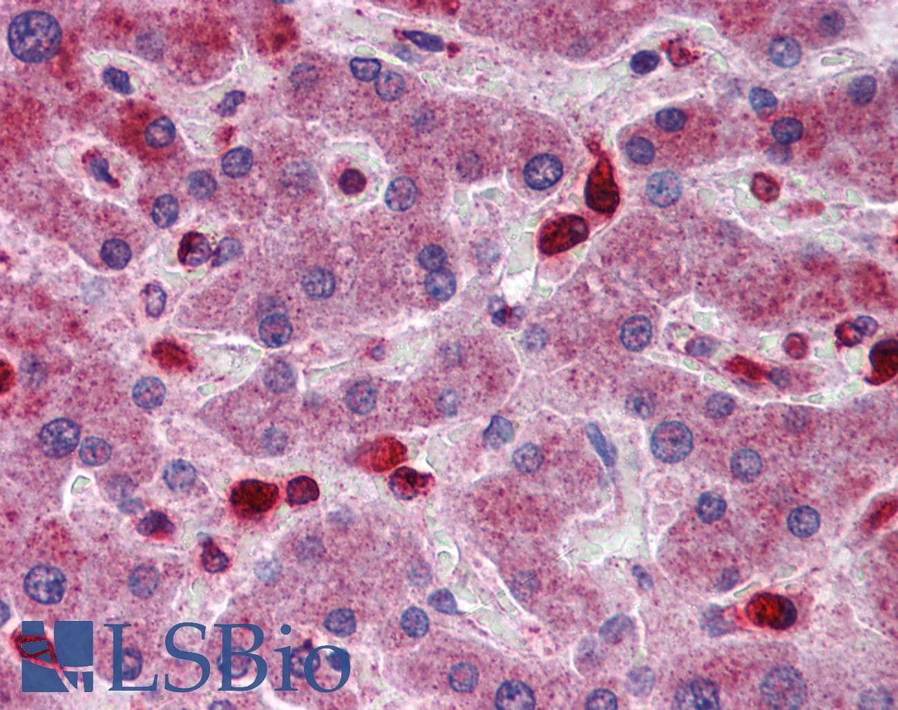 ACP2 / Acid Phosphatase 2 Antibody (aa144-193)