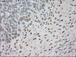 Monoclonal Mouse anti-Human BUB1B / BubR1 Antibody (clone OTI10B7, IHC, IF, WB)