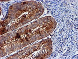 IHC-plus™ CST3 / Cystatin C Antibody (clone 2C8)
