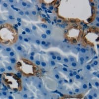 Polyclonal Rabbit anti-Human HSD3B7 Antibody (Internal, IHC, WB)