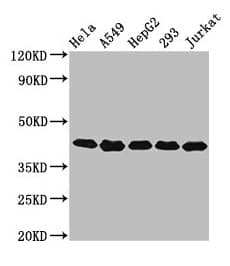 POLDIP3 / p46 Antibody