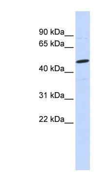 Polyclonal Rabbit anti-Human CSPG5 / Neuroglycan C Antibody (aa108-157, WB)