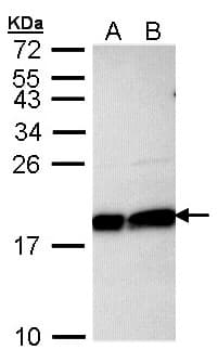 Polyclonal Rabbit anti-Human UBE2L3 / UBCH7 Antibody (aa92-154, IHC, WB)