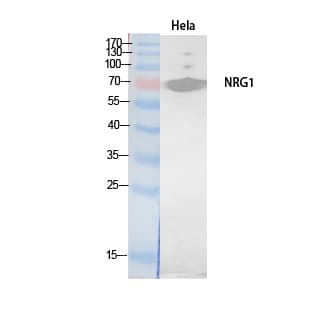 NRG1 / Heregulin / Neuregulin Antibody