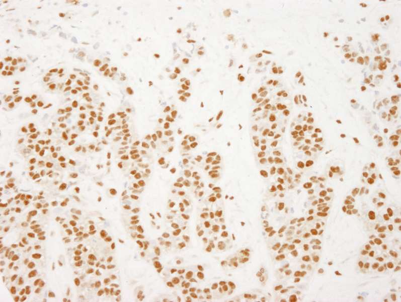 Polyclonal Rabbit anti-Human NELFE / RD / RDBP Antibody (aa330-380, IHC)