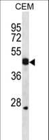 Polyclonal Rabbit anti-Human WIF1 Antibody (aa344-373, WB)