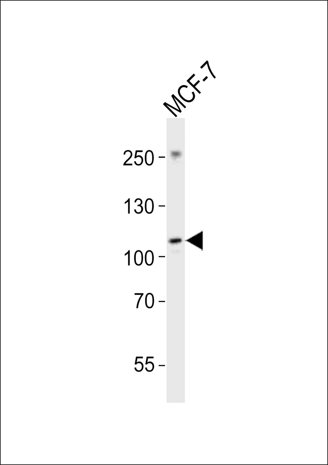 NTRK3 / TRKC Antibody (aa393-426)