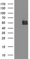 BCAT1 / ECA39 Antibody (clone 3F5, Carrier-free)