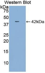 CCL4 / MIP-1 Beta Antibody (aa1-92)