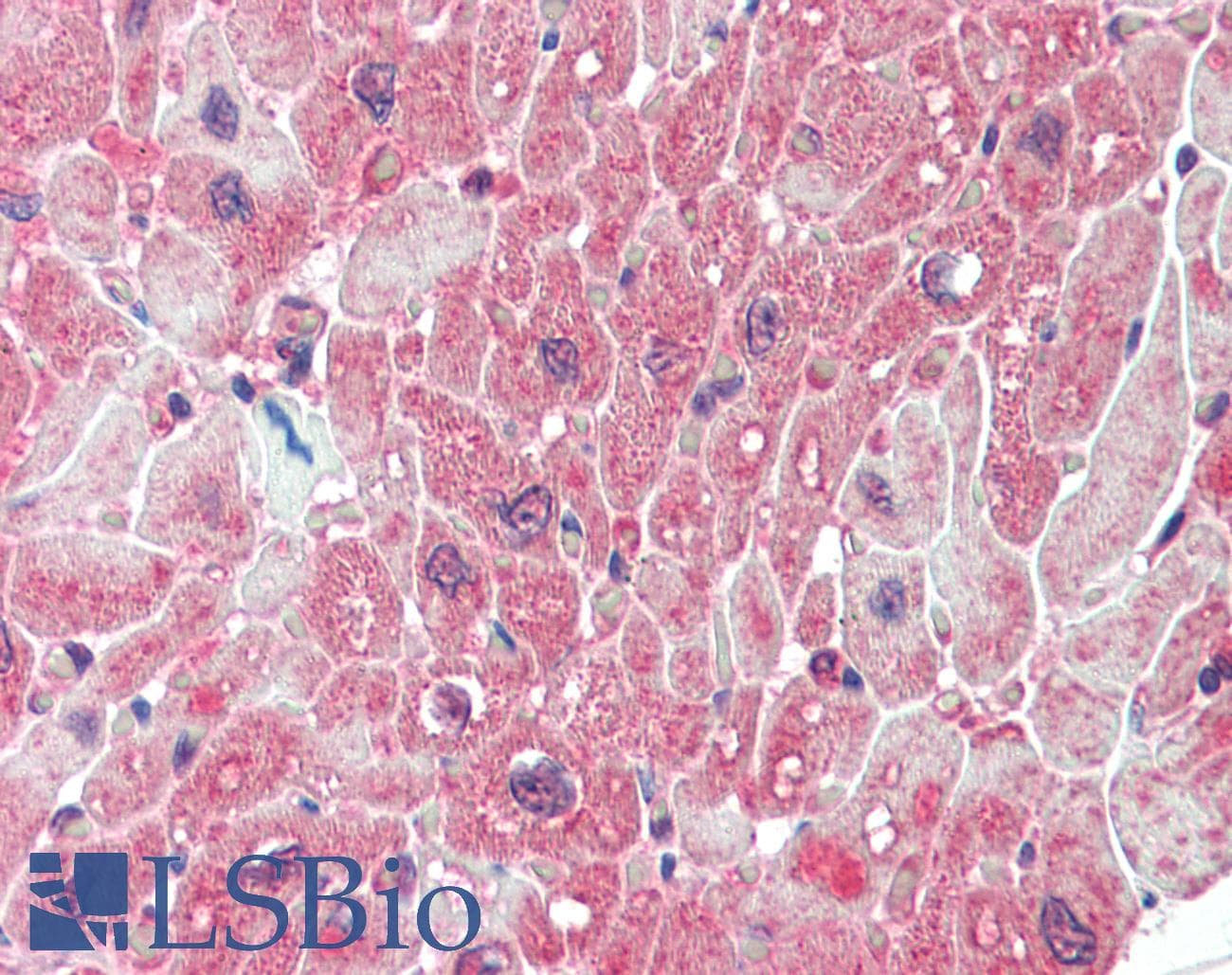 IHC-plus™ PPP2R5A Antibody (aa473-486)