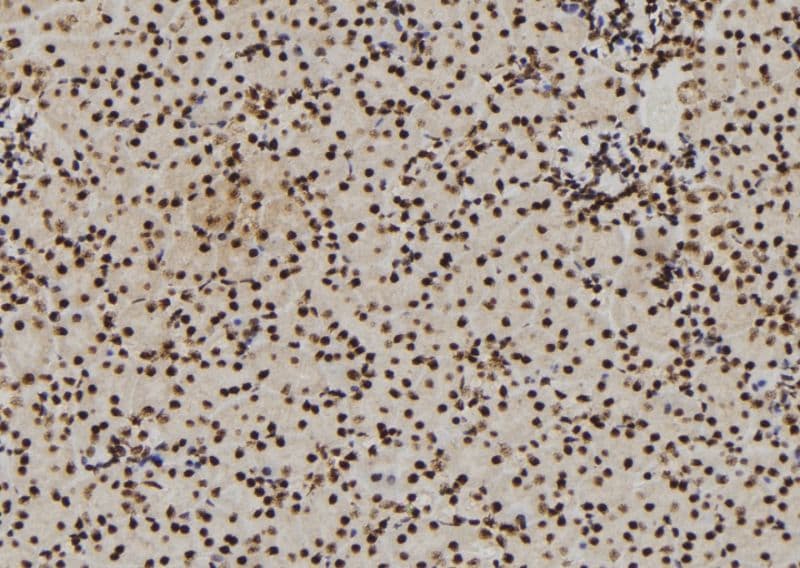 DDX21 Antibody