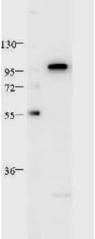 IHC-plus™ STAT2 Antibody (Tyr690, clone 19G8.H2.H6)