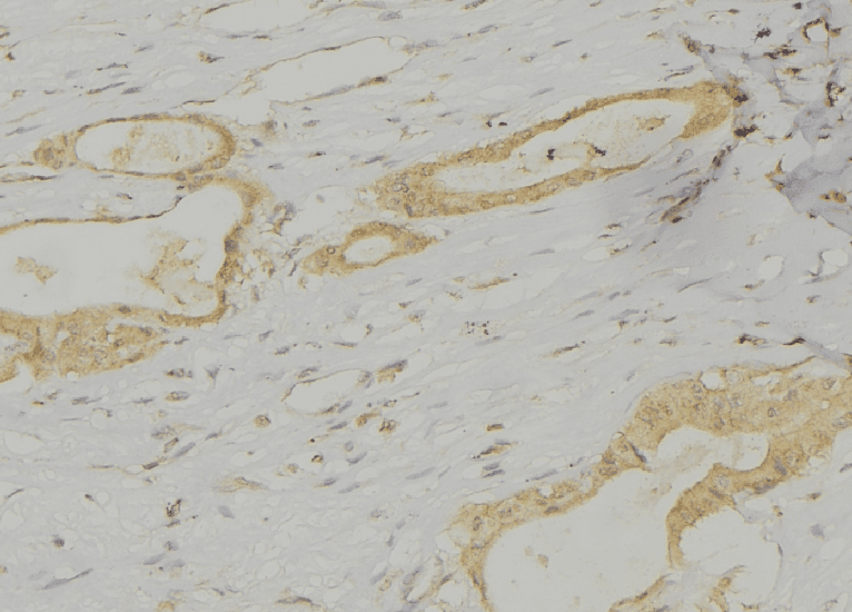 Polyclonal Rabbit anti-Human LAMP3 / CD208 Antibody (aa116-144, IHC, IF, WB)