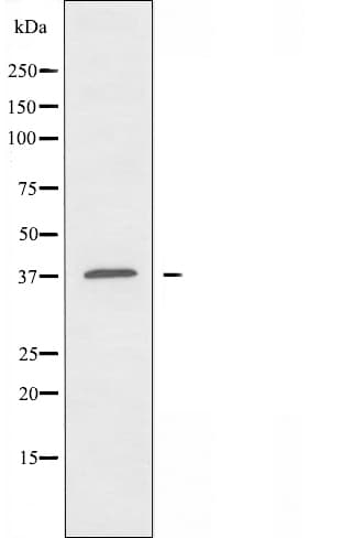 Polyclonal Rabbit anti-Human ALDOA / Aldolase A Antibody (IF, WB)