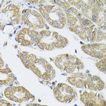 VEPH1 Antibody
