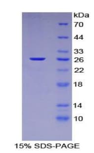 Mouse NUP133 Protein (Recombinant His-T7)