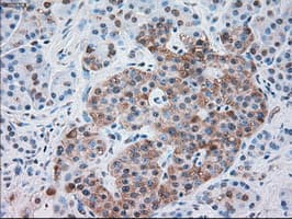 SERPINA1 / Alpha 1 Antitrypsin Antibody (clone OTI8E3)