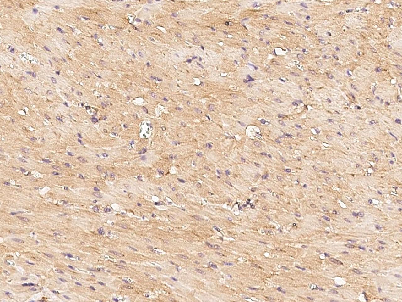 Polyclonal Rabbit anti-Mouse FNDC5 / Irisin Antibody (Preservative Free, IHC)