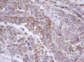 IF3mt / MTIF3 Antibody (aa56-278, clone OTI4B6)
