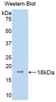Kinesin 5A / KIF5A Antibody (aa473-605)