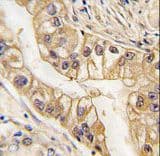EPHB2 / EPH Receptor B2 Antibody (clone 48CT12.6.4)