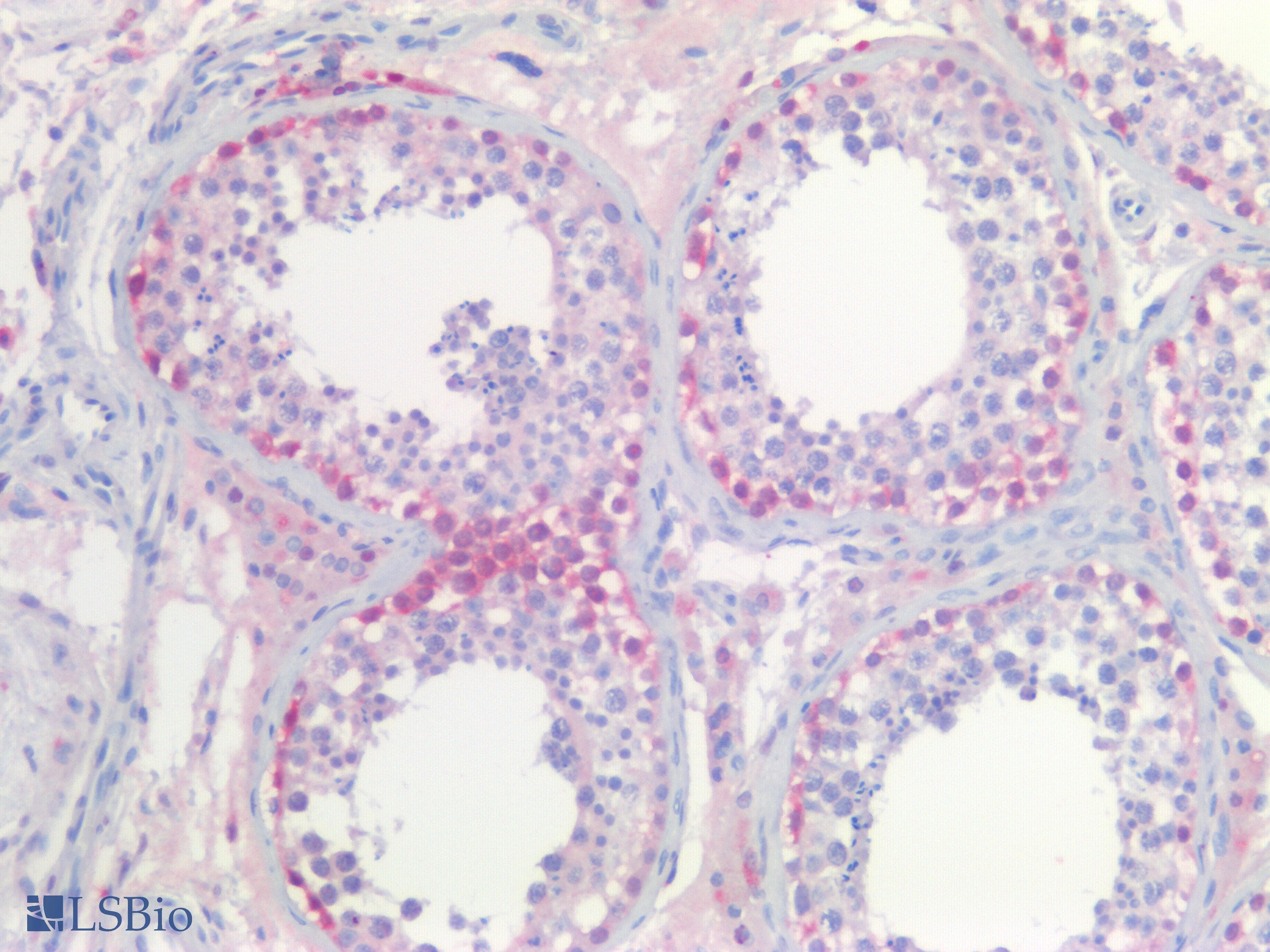 PathPlus™ UCHL1 / PGP9.5 Antibody (aa150-C-term)