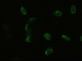 PDX1 Antibody (clone OTI2A12)