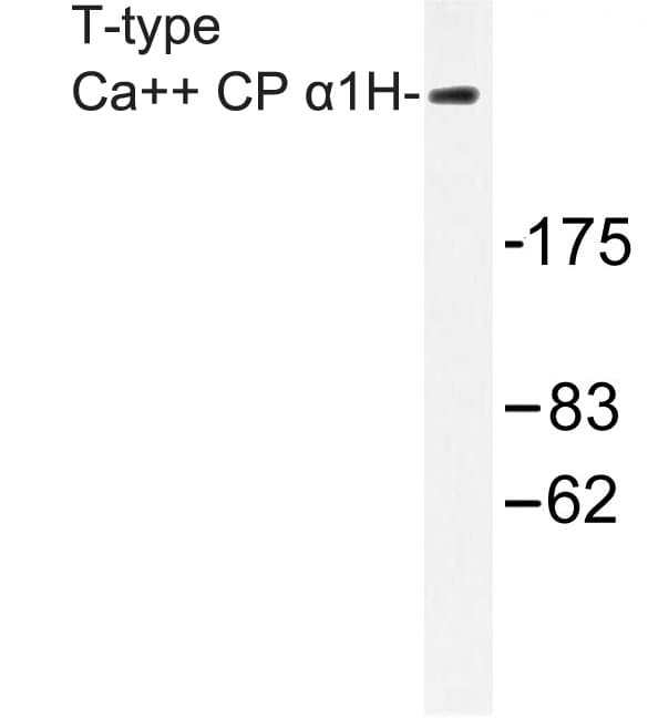 CACNA1H / Cav3.2 Antibody (Pro492)