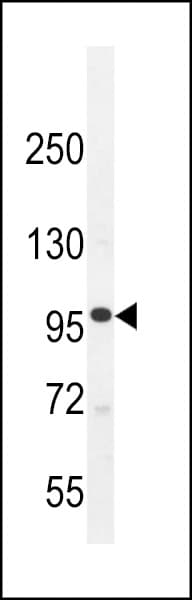 Polyclonal Rabbit anti-Human MYLK3 Antibody (aa535-562, IHC, WB)