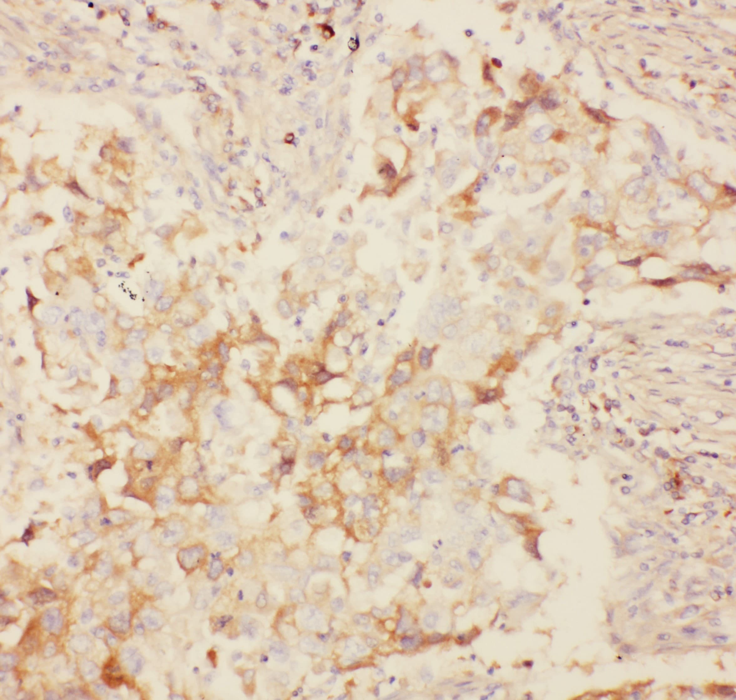 KCNB1 / Kv2.1 Antibody (aa687-858)