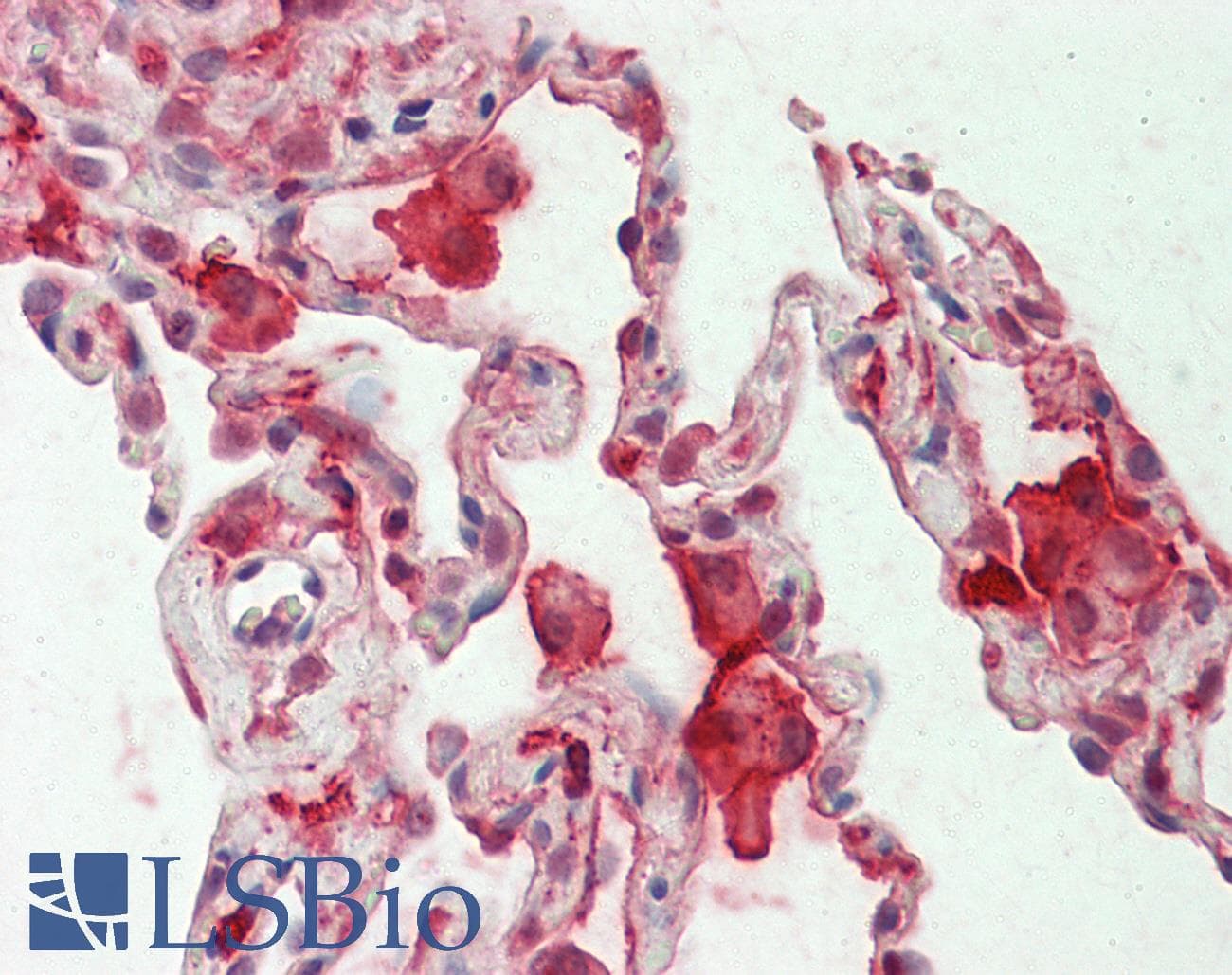 IHC-plus™ CAPG Antibody (aa205-217)